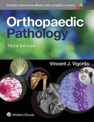 Orthopaedic Pathology - Click Image to Close