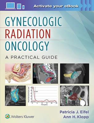 Gynecologic Radiation Oncology: A Practical Guide - Click Image to Close