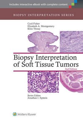 Biopsy Interpretation of Soft Tissue Tumors - Click Image to Close