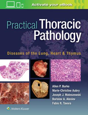Practical Thoracic Pathology - Click Image to Close