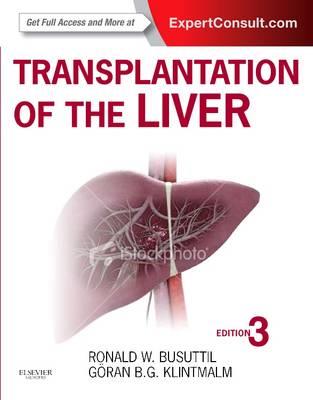 Transplantation of the Liver 3rd Edition - Click Image to Close