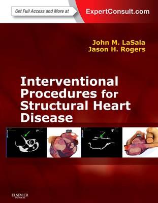 Interventional Procedures for Adult Structural Heart Disease - Click Image to Close