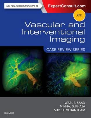 Vascular and Interventional Imaging: Case Review Series - Click Image to Close