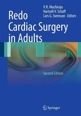Redo Cardiac Surgery in Adults - Click Image to Close