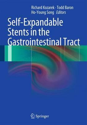 Self-Expandable Stents in the Gastrointestinal Tract - Click Image to Close