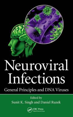 Neuroviral Infections - Click Image to Close