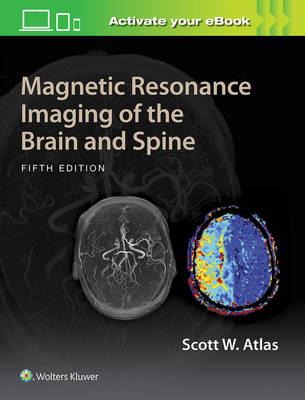 Magnetic Resonance Imaging of the Brain and Spine - Click Image to Close