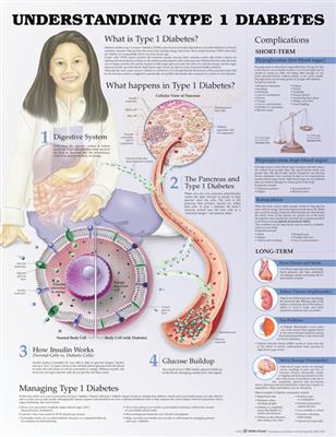 Understanding Type 1 Diabetes Anatomical Chart - Click Image to Close