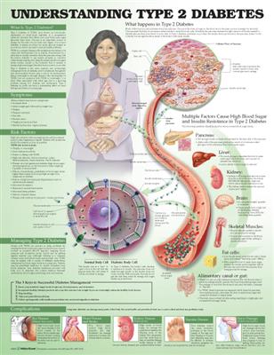 Understanding Type 2 Diabetes Anatomical Chart - Click Image to Close