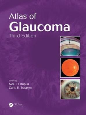 Atlas of Glaucoma - Click Image to Close