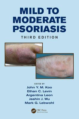 Mild to Moderate Psoriasis - Click Image to Close