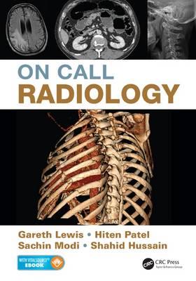 On Call Radiology - Click Image to Close