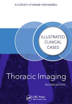Thoracic Imaging - Click Image to Close