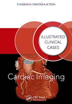 Cardiac Imaging - Click Image to Close