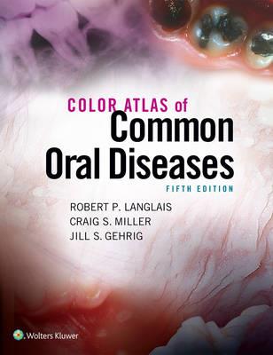 Color Atlas of Common Oral Diseases - Click Image to Close