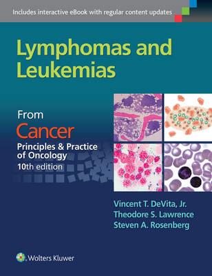 Lymphomas and Leukemias - Click Image to Close