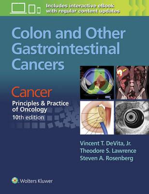 Colon and Other Gastrointestinal Cancers - Click Image to Close