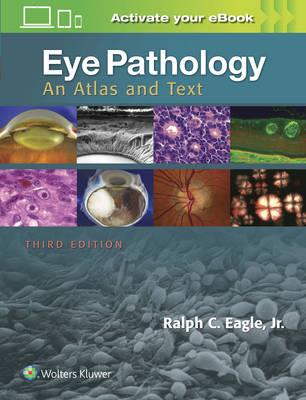 Eye Pathology - Click Image to Close
