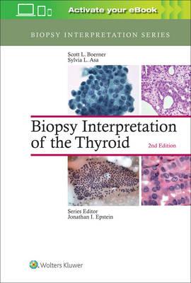 Biopsy Interpretation of the Thyroid - Click Image to Close