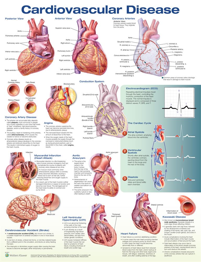 Cardiovascular Disease - Click Image to Close