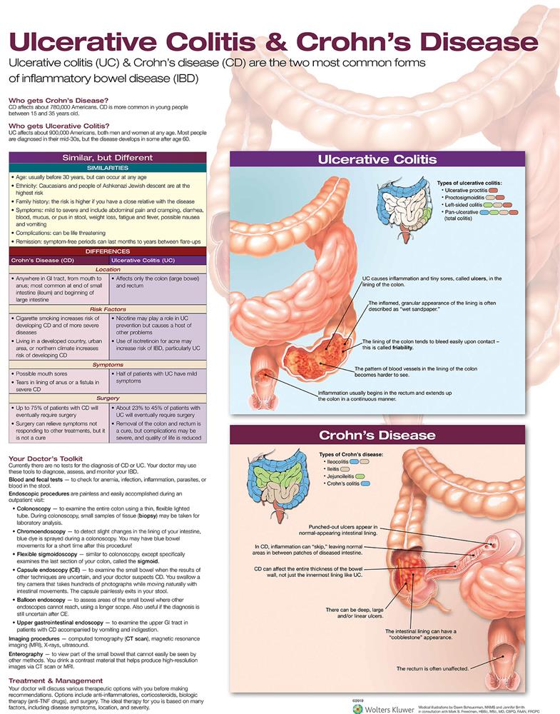 Ulcerative Colitis amp; Crohn's Disease - Click Image to Close