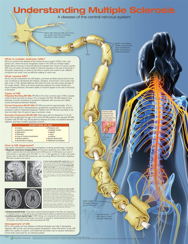 Understanding Multiple Sclerosis - Click Image to Close