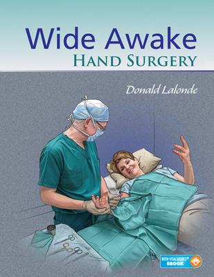 Wide Awake Hand Surgery (Book + Ebook) - Click Image to Close