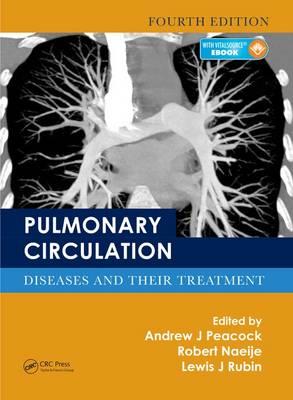 Pulmonary Circulation - Click Image to Close