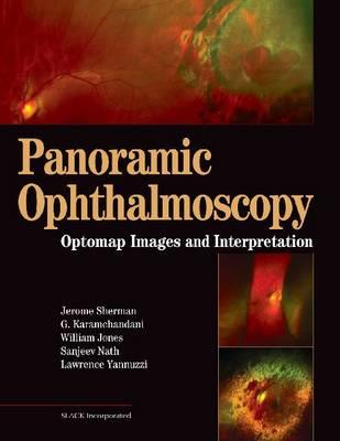 Panoramic Ophthalmoscopy - Click Image to Close