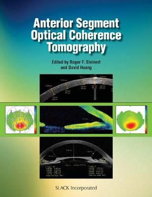 Anterior Segment Optical Coherence Tomography - Click Image to Close