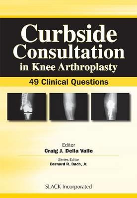 Curbside Consultation in Knee Arthroplasty - Click Image to Close