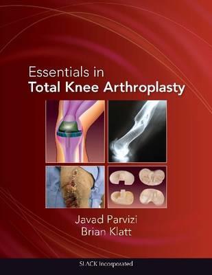 Essentials in Total Knee Arthroplasty - Click Image to Close