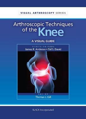 Arthroscopic Techniques of the Knee: A Visual Guide - Click Image to Close