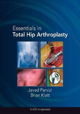 Essentials in Total Hip Arthroplasty - Click Image to Close