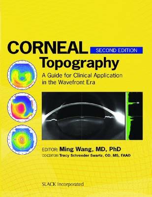 Corneal Topography - Click Image to Close