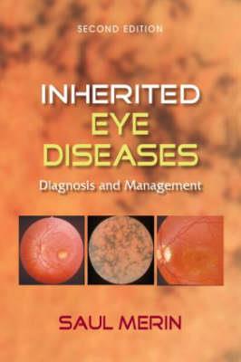 Inherited Eye Diseases - Click Image to Close