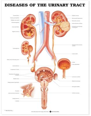 Diseases of the Urinary Tract Anatomical Chart - Click Image to Close