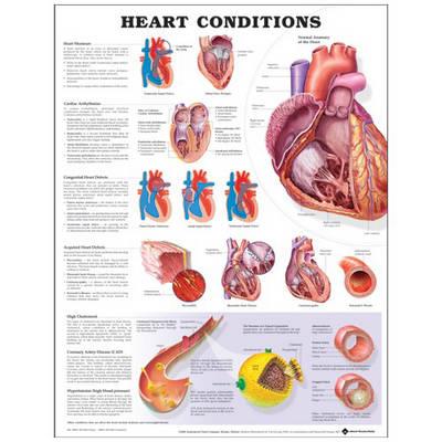 Heart Conditions - Click Image to Close