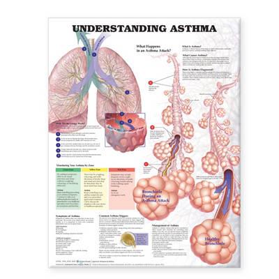 Understanding Asthma Anatomical Chart - Click Image to Close