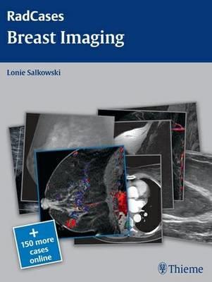 Breast Imaging - Click Image to Close