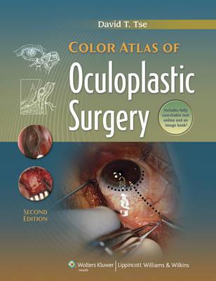 Color Atlas of Oculoplastic Surgery - Click Image to Close