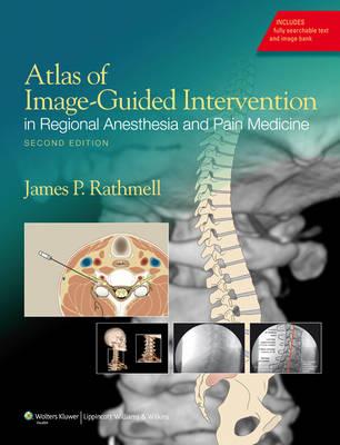 Atlas of Image-Guided Intervention in Regional Anesthesia and Pain Medicine - Click Image to Close