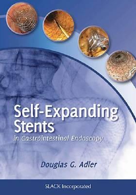 Self-Expanding Stents in Gastrointestinal Endoscopy - Click Image to Close