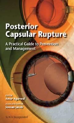 Posterior Capsular Rupture - Click Image to Close