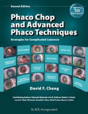 Phaco Chop and Advanced Phaco Techniques - Click Image to Close