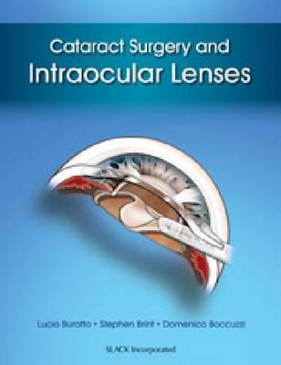 Cataract Surgery and Intraocular Lenses - Click Image to Close