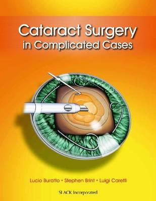 Cataract Surgery in Complicated Cases - Click Image to Close