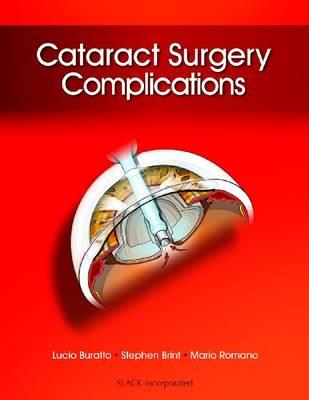 Cataract Surgery Complications - Click Image to Close