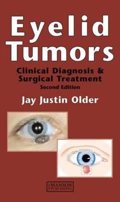 Eyelid Tumors - Click Image to Close