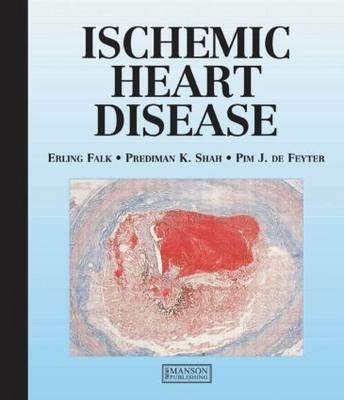 Ischemic Heart Disease - Click Image to Close